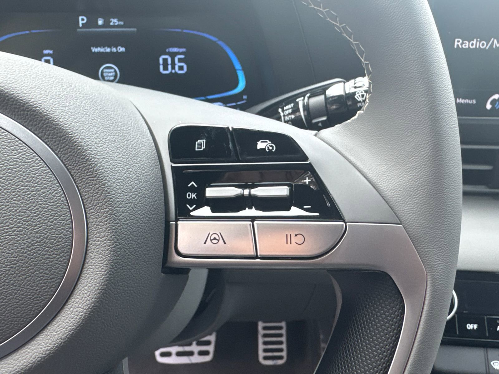 2026 Hyundai Elantra Sport