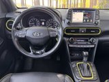 Used 2020 Hyundai Kona Ultimate w/ Cargo Package image 3