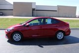 Used 2022 Hyundai Accent SE image 2