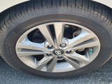 Used 2017 Hyundai Elantra Value Edition image 3