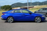 New 2025 Hyundai Elantra Sport image 2