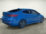 Used 2017 Hyundai Elantra Sport image 5