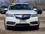 Used 2015 Acura MDX SH-AWD w/ Technology Package image 2