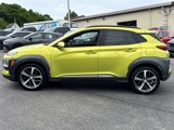 Used 2018 Hyundai Kona Limited image 4