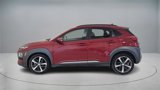 Used 2020 Hyundai Kona Ultimate image 4