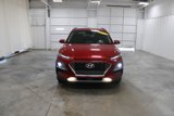 Used 2021 Hyundai Kona Ultimate image 3