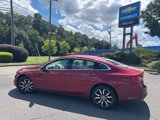 Used 2017 Chevrolet Malibu LT image 2