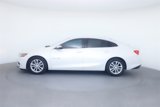 Used 2017 Chevrolet Malibu LT image 2
