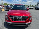 New 2025 Hyundai Venue Limited image 3