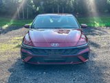 Used 2024 Hyundai Elantra SEL image 2