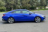 Certified 2024 Hyundai Elantra SEL w/ Convenience Package image 3