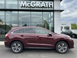 Used 2018 Acura RDX AWD w/ Advance Package image 2