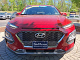 Used 2021 Hyundai Kona Ultimate image 2