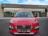 Used 2018 Hyundai Kona Ultimate image 2