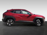 Used 2024 Hyundai Kona SEL image 4