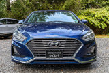 Used 2018 Hyundai Sonata SE image 2