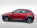 Used 2020 Hyundai Kona Limited image 6