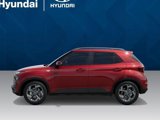 New 2025 Hyundai Venue SEL image 3
