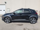 Used 2021 Hyundai Kona Ultimate image 2