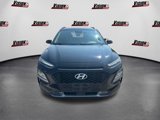 Used 2018 Hyundai Kona SEL w/ SEL Tech Package 02 image 2