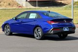 New 2025 Hyundai Elantra Sport image 5