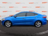 Used 2017 Hyundai Elantra Limited image 2