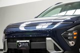 Used 2024 Hyundai Kona SEL image 2