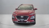 Used 2020 Hyundai Kona Ultimate image 2