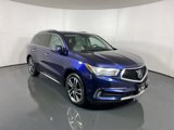 Used 2017 Acura MDX SH-AWD w/ Advance Package image 3
