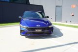New 2025 Hyundai Elantra Sport image 2