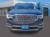 Used 2018 GMC Acadia SLT image 2