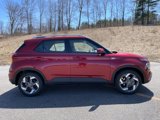 New 2025 Hyundai Venue SEL image 3