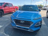 Used 2018 Hyundai Kona Ultimate image 2