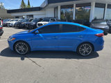 Used 2018 Hyundai Elantra SE image 2