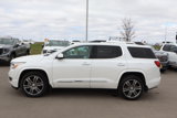 Used 2018 GMC Acadia Denali w/ Technology Package image 4