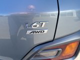Used 2019 Hyundai Kona Limited image 5
